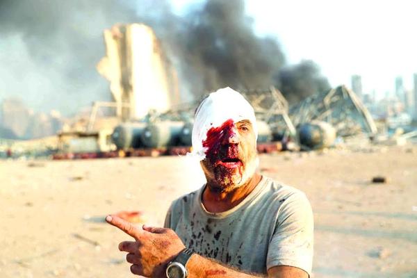 AP Photo/Hassan Ammar