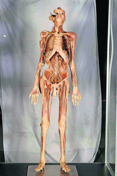 bodies
