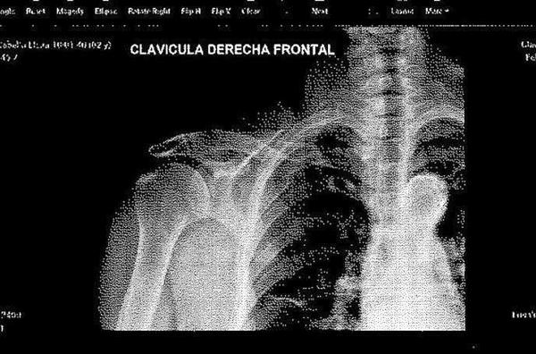 radiografía
